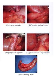 this really bad abdominal