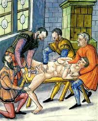Castration (What we do to