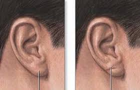 Ver imagen en tamaño completo