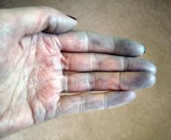 ... Shift+R improves the quality of this image. CTRL+F5 reloads the whole page.