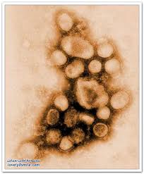 مرض انفلونزا الخنازير 3298.imgcache