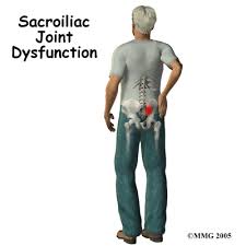 Sacroiliac (SI) joint