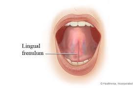 The lingual frenulum is a band
