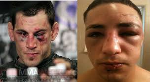 Diego Sanchez on the UFC on