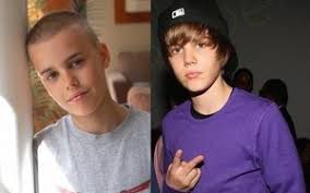 Justin Bieber Bald