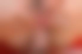 陰核まんこ無修正|陰核小帯 - Wikipedia