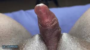 Clitóris grande jpg x Clitoris grande