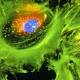 Two Kidney Cancer Drugs Show Promise in Separate Studies 