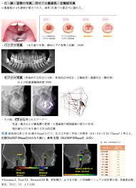 韓国中学生おっぱい流出|13歳少女らの裸の画像をＡＩで捏造、ＳＮＳで共有 スペイン