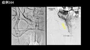 MRI まんこ|MRLsexdoll 人形 エロ シリコン製 オナホ フィギュア（学園の女神シリーズ） – MRLSEXDOLL-JP