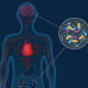 Understanding of Parkinson's 'transformed' 