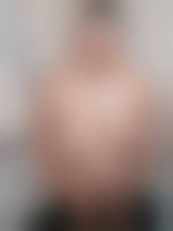 downs syndrome girl nude|Carla Down syndrome nudity - Photo #4 / 7 @ x3vid.com