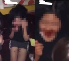 여자초등학생 가슴|생후 일주일 남아, 가슴 커지고 모유 나와…'2%'만 겪는 희귀질환 - 뉴스1