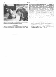 child in erection| / X