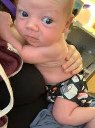 diaper rash naked |Diaper Naked Royalty-Free Images, Stock Photos & Pictures | Shutterstock