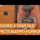Haunting image of child pulled from Aleppo rubble is symbol of Syria 