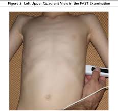 pedactric genital exam of child|Pediatric examination hi-res stock photography and images - Alamy