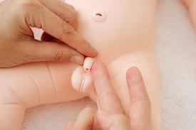 赤ちゃん　股間|赤ちゃんの股関節脱臼 ―正しい知識と早期発見のために― | 日本小児整形外科学会