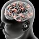 Qld breakthrough in Parkinson's treatment 