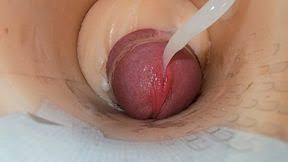 Endoscope camera inside anal videos free porn videos jpg x Endoscope anal