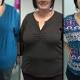 Unexpected pregnancy, hair loss - meet Australia's 'dangerous' new diet 