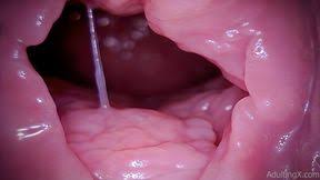 Anal medical endoscope dirty session scatshop jpg x Endoscope anal