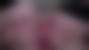 anorexic prolapse pussy ai porn|Fluffy Pixie-cut, Rectal Anus Prolapse, Plumped PussyPorno IA