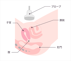 MRI まんこ|婦人科での診察・検診 | ワタシのカラダ相談室