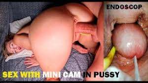 Endoscope anal jpg x Endoscope anal