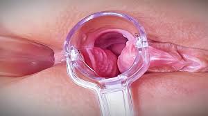 Eaftggaaaa qsbe jpg x Vaginal speculum