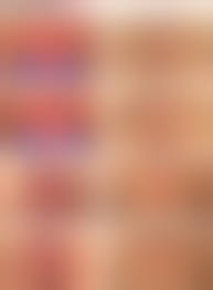 pussy before and after|Loose Vagina - Radiant Rejuvenation - Seattle