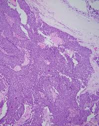 kim hyo jin fake nude|Park Bo-young - Wikipedia