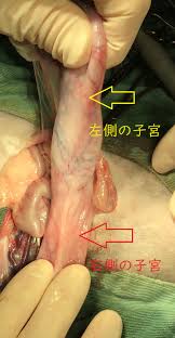 子宮脱|子宮が降りてくる？違和感？子宮脱の初期症状とは？もしかして…と思ったら | 【公式】フェミクッション | 三井メディカルジャパン