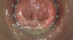 Sensational anal endoscopy and orgasms your giantess puts you in her ass and big vagina jpg x Endoscope anal