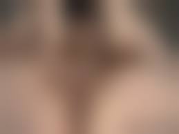 陰核まんこ無修正|症例写真】小陰唇縮小＋クリトリス包茎の症例：美容外科 高須クリニック