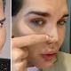 Plastic surgery addict who became Ken doll admitted to hospital with rotting nose 