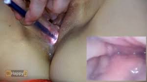 Deep anal endoscope gay porn popular videos gay bingo jpg x Endoscope anal