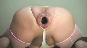 Is vagina normal shape size vulva labia jpg x Vulva tube