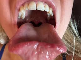 sperm on tongue| / X