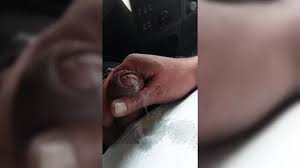 Worm sex jpg x Worm sex