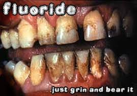 http://t3.gstatic.com/images?q=tbn:ANd9GcS-1ujwS239uKq-klnV6q4p7eGQXOP1Mmu47efkPzgF3RvcY8aStw
