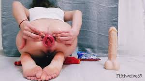 Asian anal prolapse jpg x Asian anal prolapse