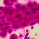 Cell phone radiation increases cancers in rats, but should we worry? 