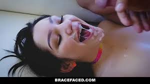 Young naked teen braces pic jpg x Teens with braces