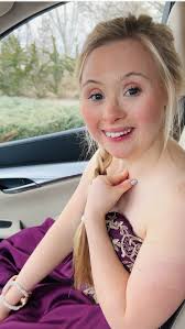 downs syndrome girl nude|_rachel00 / rachel000 Nude Leaked OnlyFans Photo #389 - Fapello