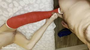 Leg cast jpg x Leg cast