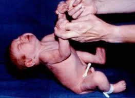 child in erection|Kids and Bedwetting: When Should I Be Concerned?