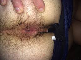 Hairy armpits teen anal creampie jpg x Hairy anal creampie