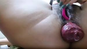 Search oe utf asian anal prolapse porn isz en safe off udm ec gadaaq jpg x Asian anal prolapse