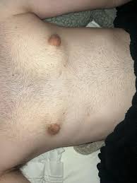 tiny puff nipples|What Are Puffy Nipples | Get Rid of Prominent glands in 2024